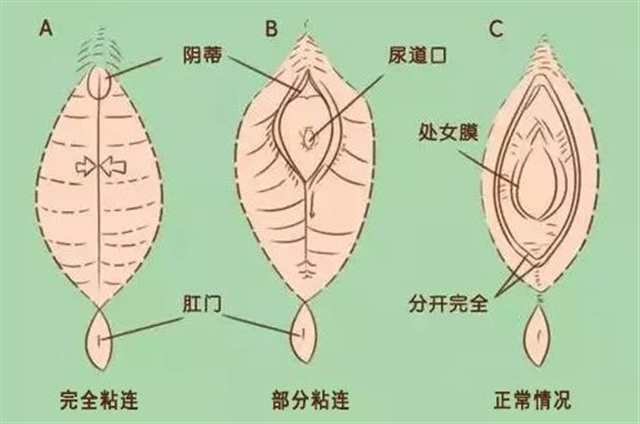 女人的下面有几种型号图片