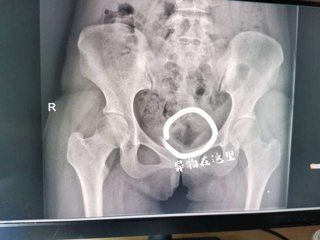  捏r头技巧 往下边塞冰棒感觉